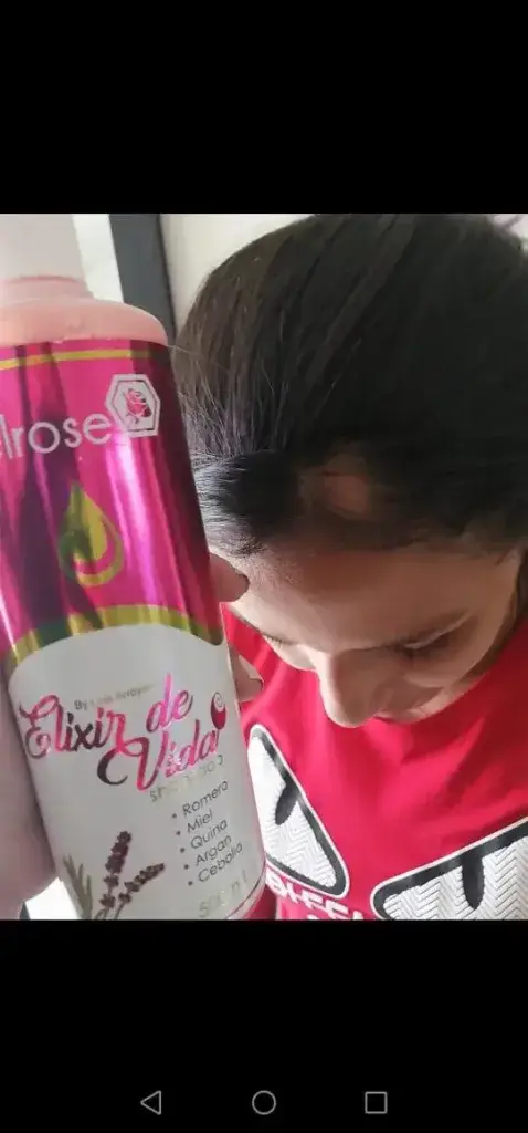 shampoo para la caida del cabello en hombres DESPUES